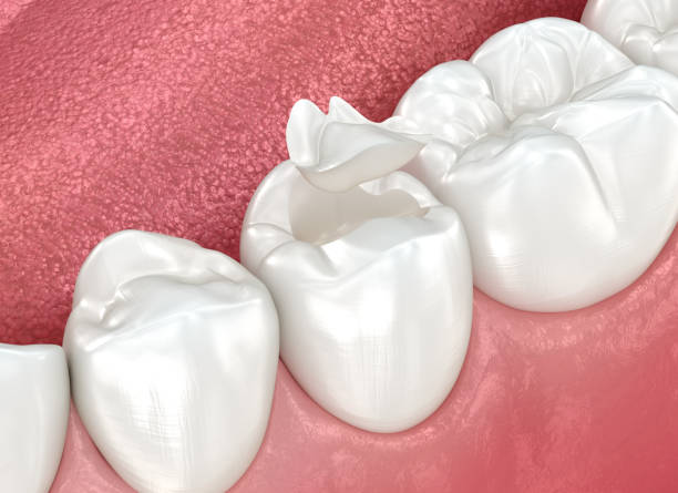 Best Cosmetic Dentistry  in Kingsley, MI